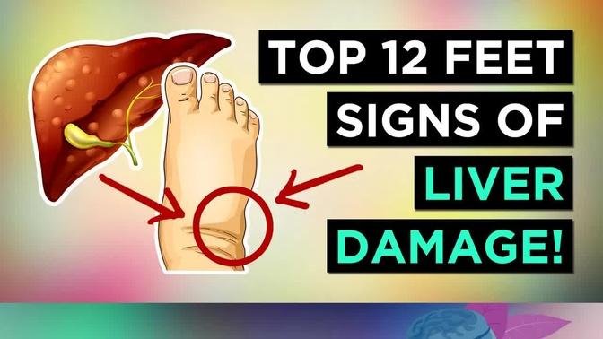 12-signs-your-feet-give-about-liver-problems