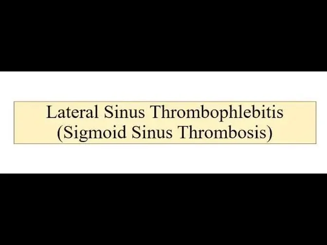 Lateral Sinus Thrombophlebitis