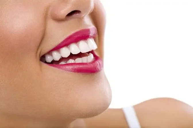 Budget-Friendly Teeth Whitening: Dubai's Affordable Options