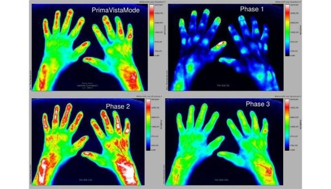 Global Optical Imaging Market 2023 Insights, Size, Share, Analysis, Forecast to 2030