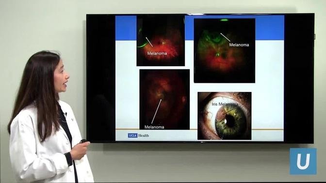 Eye Cancer Surgery at UCLA: Part II | Tara McCannel, MD | UCLAMDChat