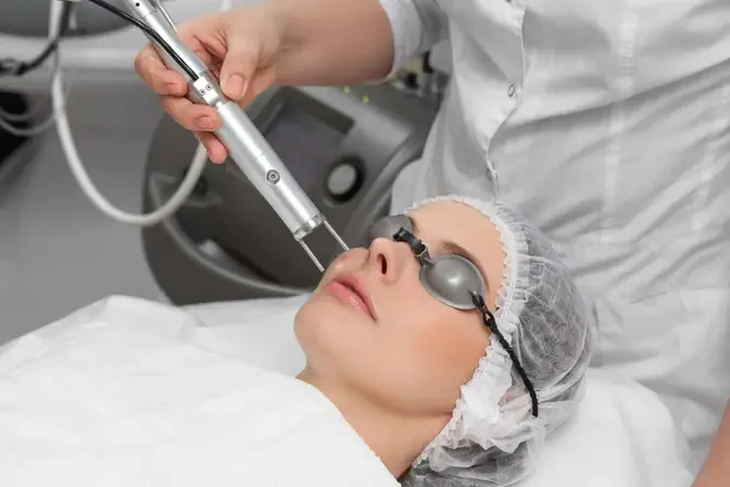 Fractional CO2 Laser Treatment in Dubai Media City