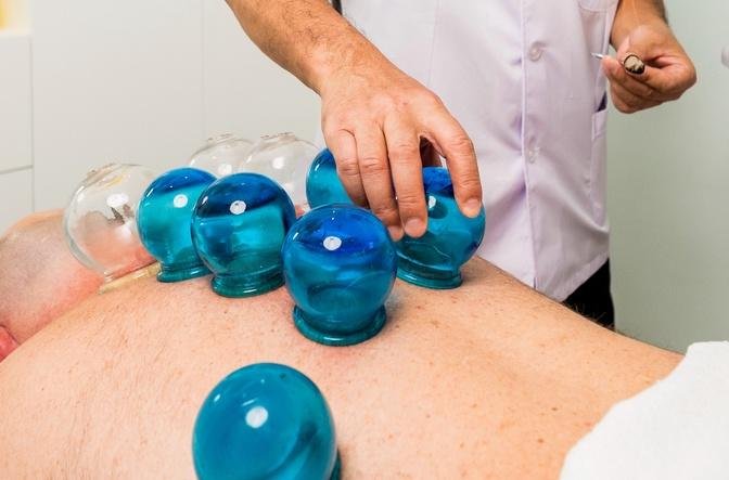 Change Your Wellbeing Process: Best Cupping Therapy In Dubai Uncovered