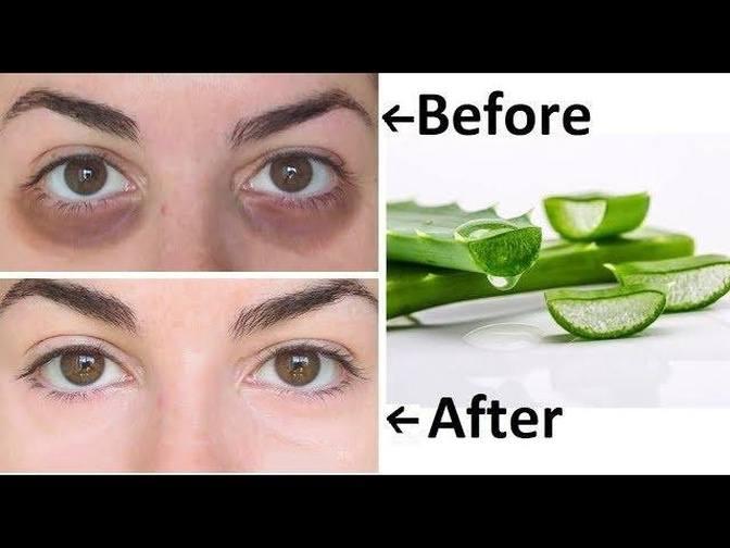 How To use Aloe Vera For Dark Circle