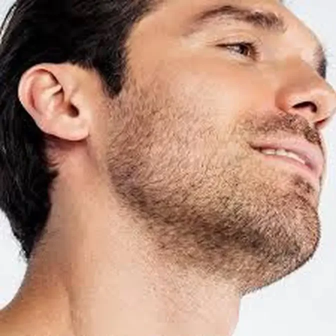 "Beard Hair Transplant in Dubai: What You Need to Know"