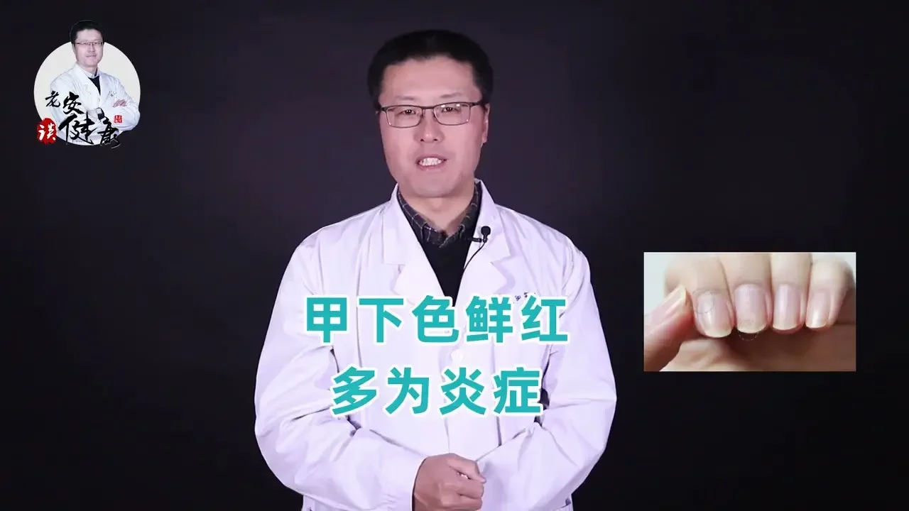 指甲变色是怎么回事｜【老安谈健康】