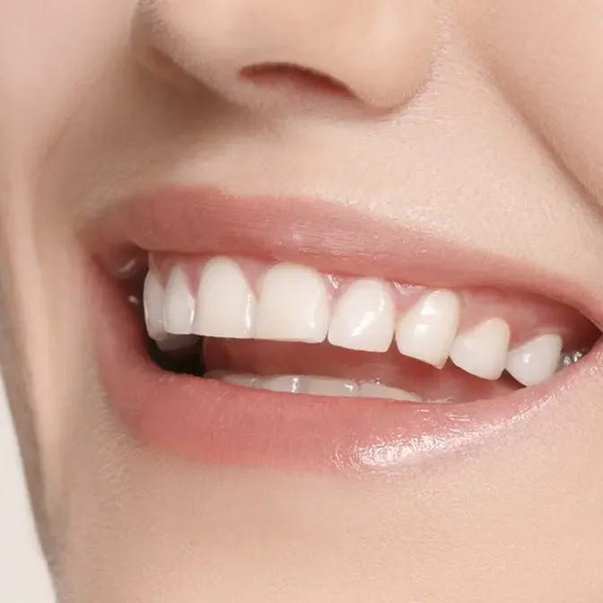 Smile Brighter, Live Better: Cosmetic Dentistry Options in Dubai