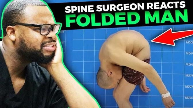 Spine Surgeon Reacts to the "Folded Man"
