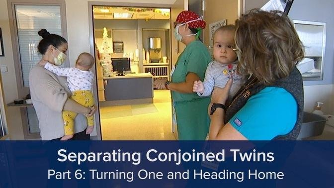 Separating Conjoined Twins Part 6: Turning One and Heading ...