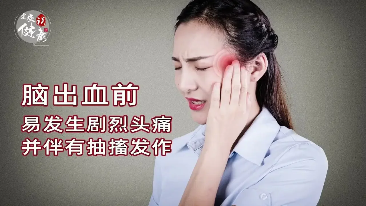 脑出血｜非死即残，如何早发现、早预防呢？征兆：动脉硬化，舌头发硬，哈欠不断，血压异常，高血压病人数次鼻出血，步态异常，突然眩晕，突然剧烈头痛，伴有抽搐。如何预防？情绪稳定，饮食，锻炼【老安谈健康】