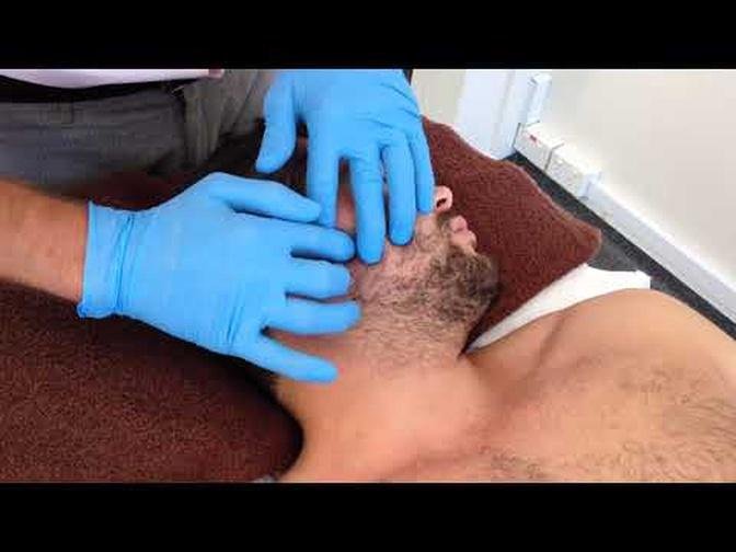 Dry Needling: Lateral Pterygoid
