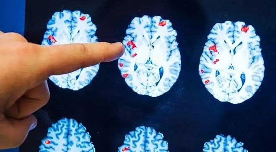 Researchers: Evidence Suggests Consciousness Continues After Clinical Death