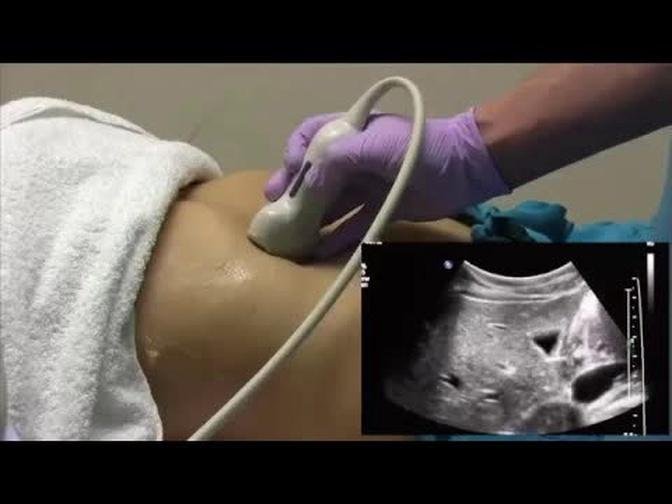 How I do it: Ultrasound of the Abdomen