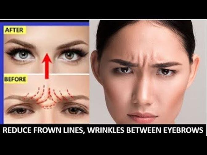 Effective massage to Get rid frown lines, Reduce Wrinkles between eyebrows Naturally