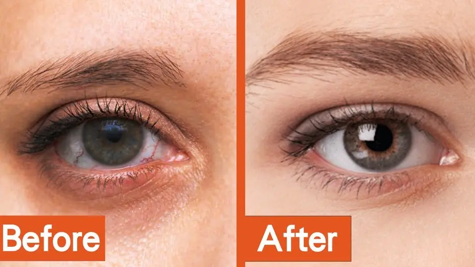 8 eye exercises to heal eyesight | Demonstration by Chinese medicine practitioner Wu Kuobin