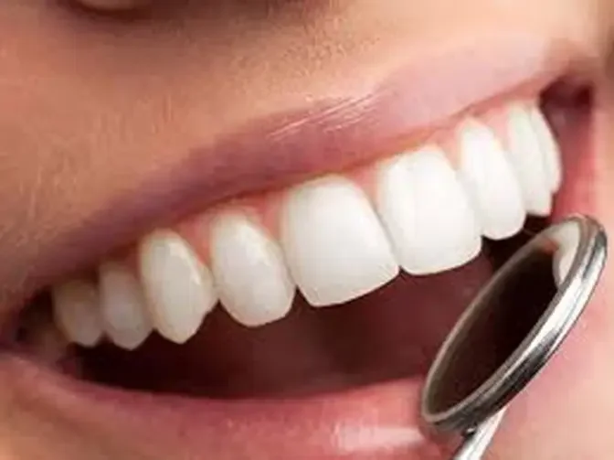 Best Teeth Crowns in Dubai: Affordable Excellence