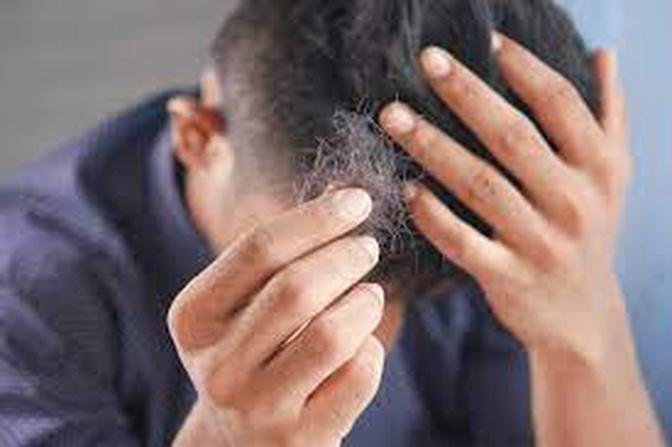 Are the results of a Hair Restoration in Dubai permanent?