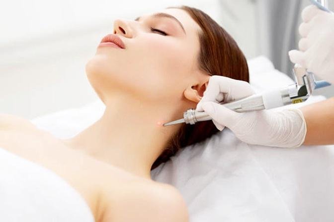 How to Minimize Scarring After Mole Removal Treatment in Dubai