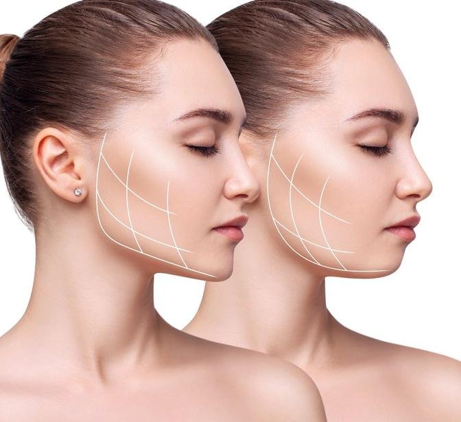 Unveiling the Secrets of Facial Rejuvenation Restoring Youthful Radiance