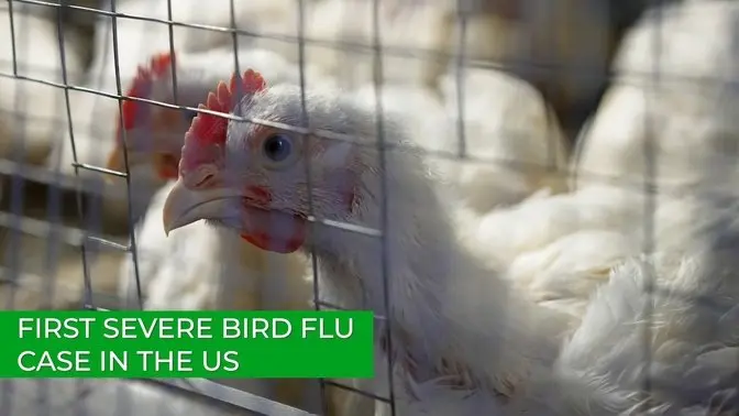 CDC Confirms First Severe Bird Flu Case in the US