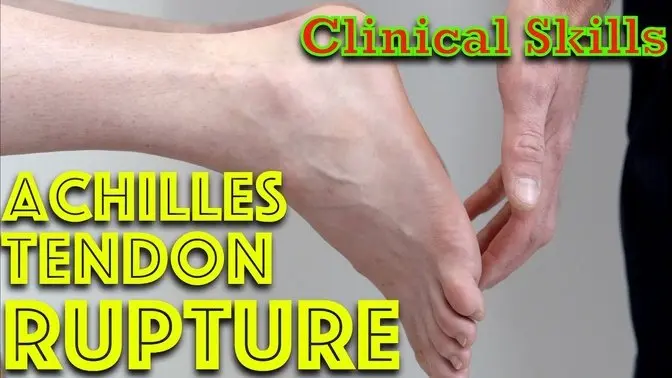 Achilles Tendon Rupture - Clinical Skills - Dr Gill