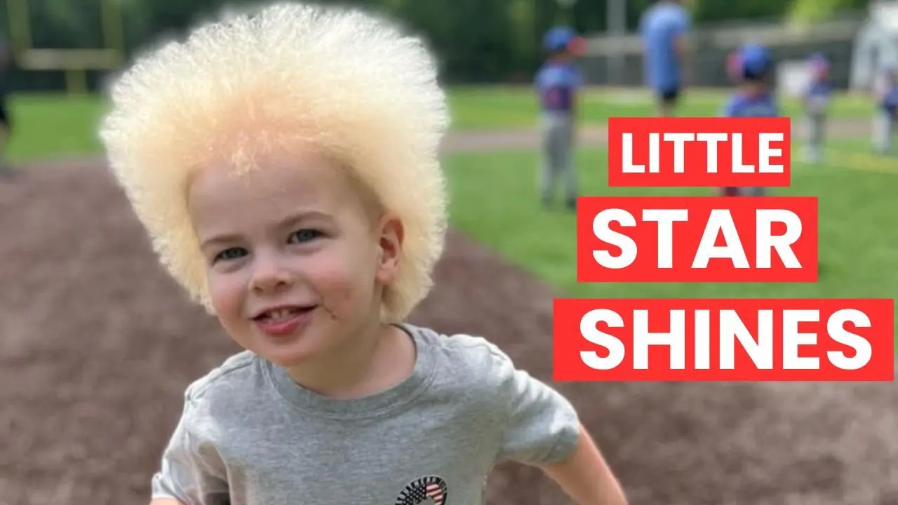 Little Boy with Rare Uncombable Hair Brings Joy Everywhere He Goes!